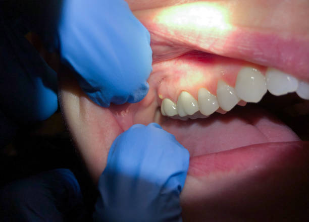 Best Emergency Care for Gum Disease in Greenville, MS